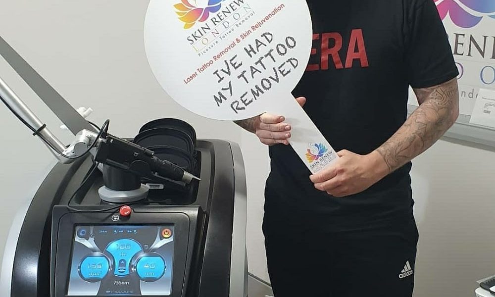 Tattoo Removal London & Essex – Skin Renew London Ltd